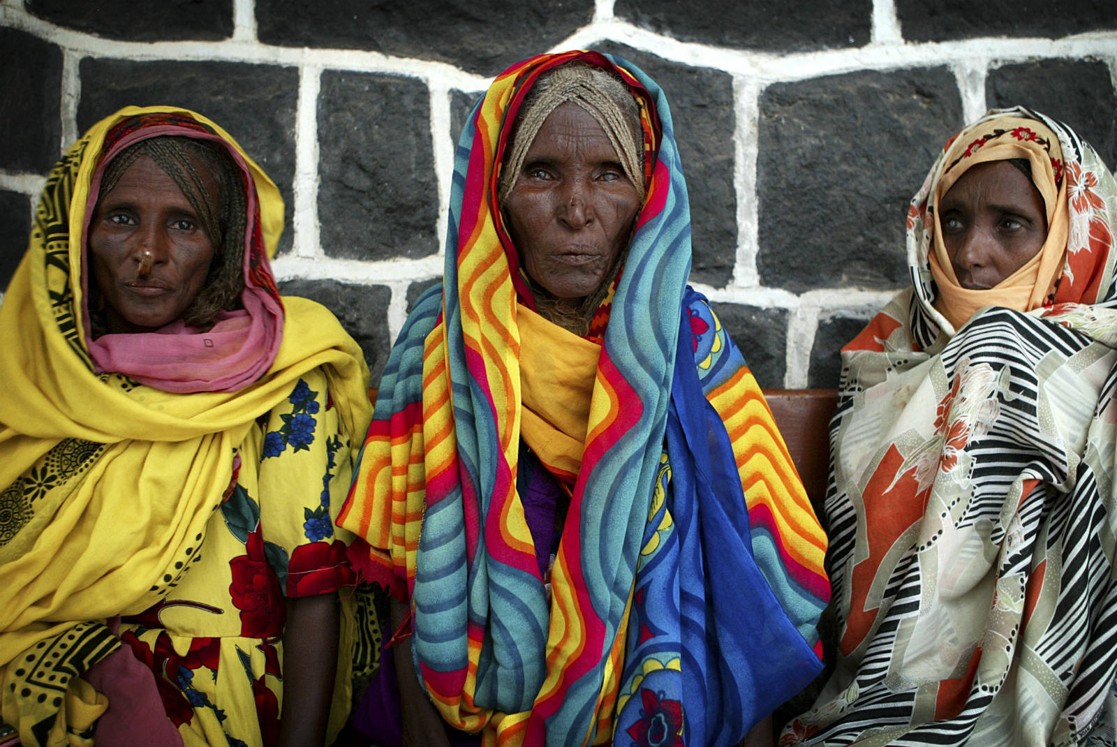 厄立特里亞在 90 年代時，剛跟埃塞俄比亞打完仗，人民生活困迫，莫說要提供優質的醫療服務。