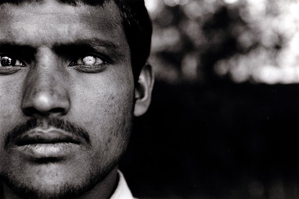 印度教相信去世時屍體必須完整，故器官捐贈風氣並不熱烈。可是眼角膜受損是尼泊爾最嚴重的眼疾之一。