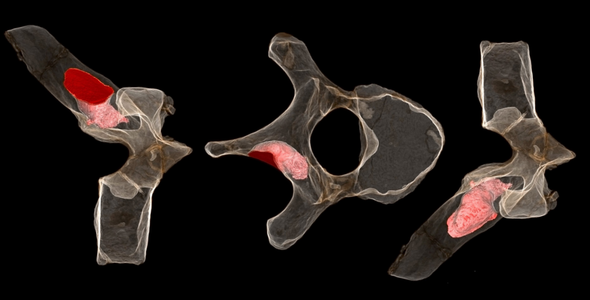 粉紅色的部份為椎骨標本中發現腫瘤的地方。圖片來源：Image: P. S. Randolph-Quinney