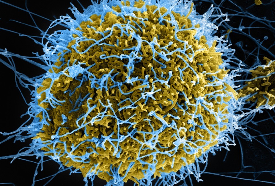 伊波拉病毒（藍）在受感染的細胞。　圖片來源：National Institutes of Health