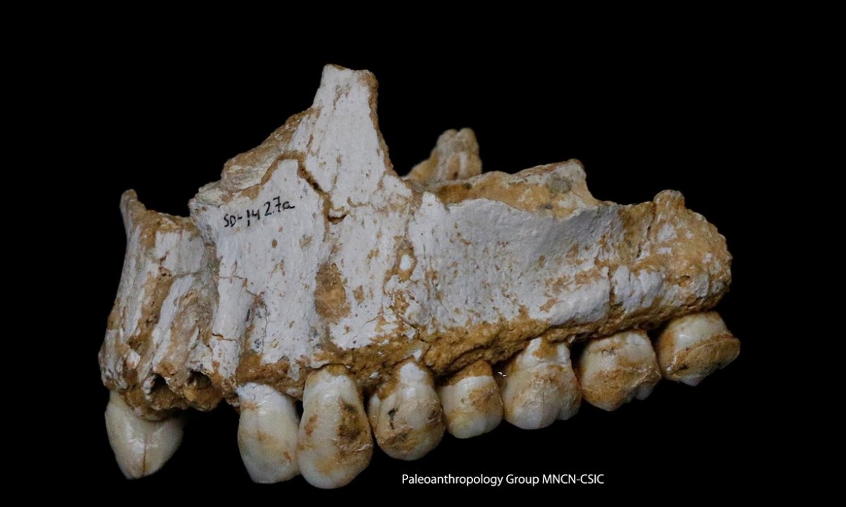 從顱骨上的牙菌斑可見，該尼安德特人曾進食楊樹皮止痛－－效用相當於阿士匹靈。　圖片來源：Paleoanthropology Group MNCN-CSIC